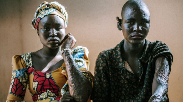 apos-perderem-a-familia-em-ataque-do-boko-haram,-orfaos-relatam:-‘deus-mandou-perdoar’