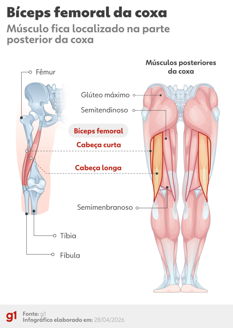 lesao-no-biceps-femoral:-entenda-problema-que-tirou-militao-da-copa-do-mundo