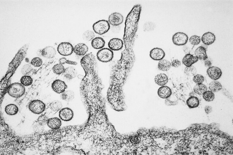 oms-confirma-seis-casos-de-hantavirus-apos-surto-em-cruzeiro